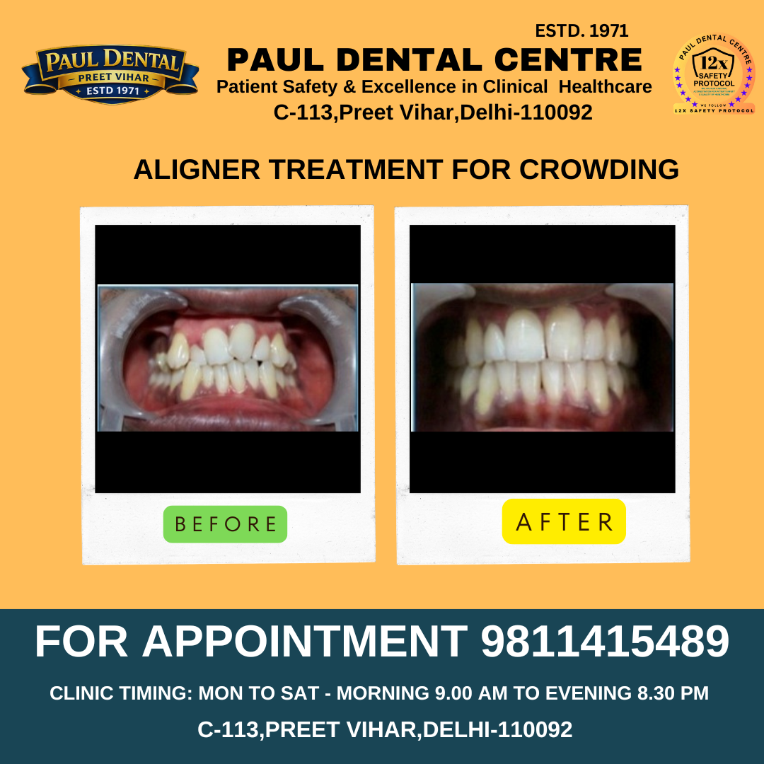 Case 23 – Paul Dental Center